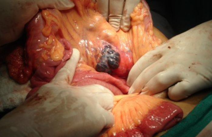 Pancreas Banner